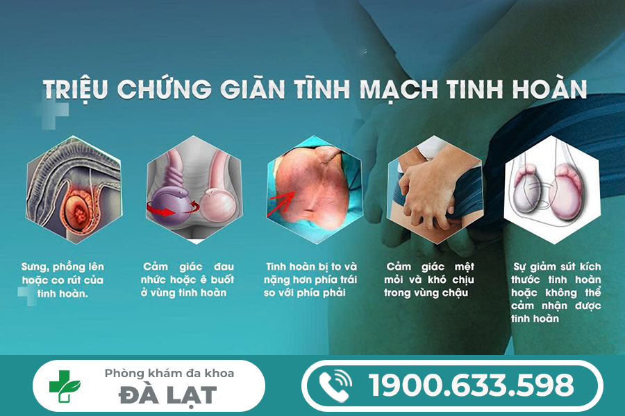 Hình ảnh minh họa